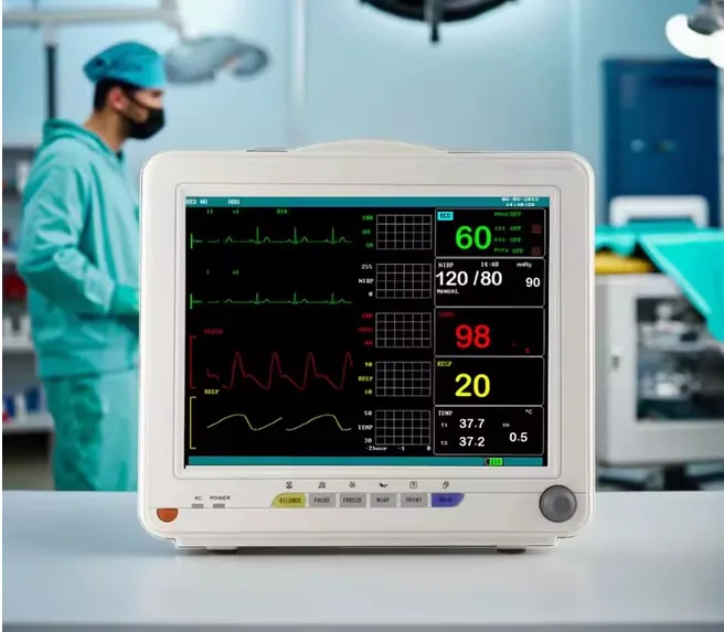 Monitor multiparamétrico en uso dentro de una sala hospitalaria con personal médico al fondo